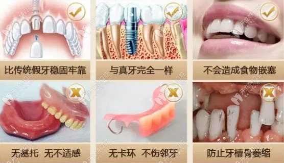 苏州新美植美呀口腔诊所 为您打造健康自信的笑容